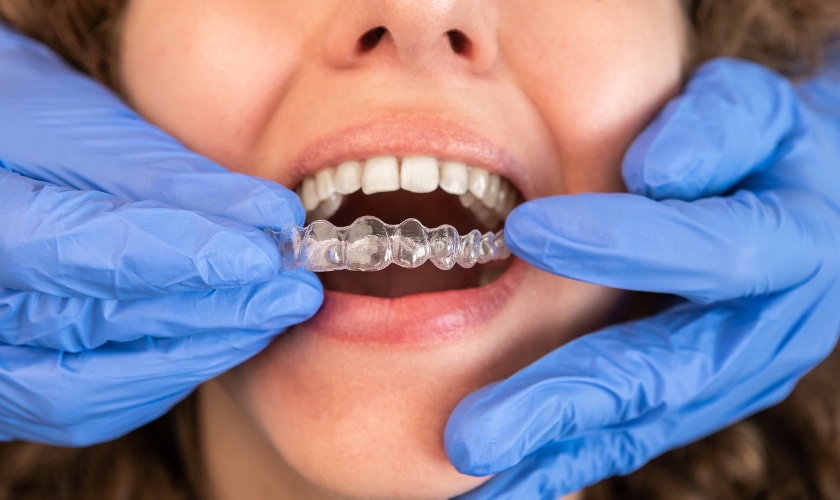 Featured image for “How Invisalign Can Correct Bite Issues: A Comprehensive Guide”