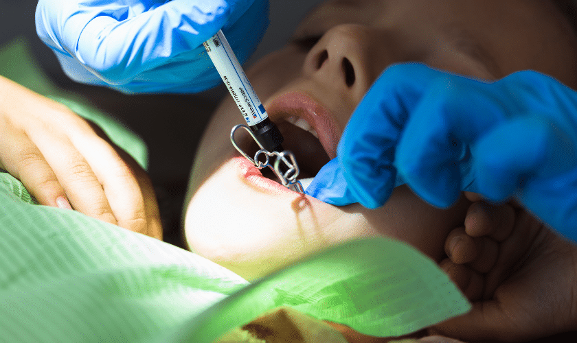 Featured image for “Why You Shouldn’t Skip Your Regular Fluoride Cleanings”