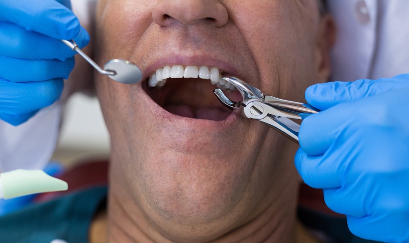 Featured image for “When is a Tooth Extraction Necessary for Orthodontic Treatment?”