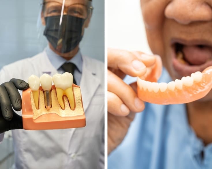 Featured image for “Get A Detailed Comparison Between Dental Implants & Dentures”