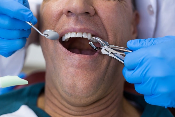 Featured image for “What to expect from immediate Restoration Dentistry?”