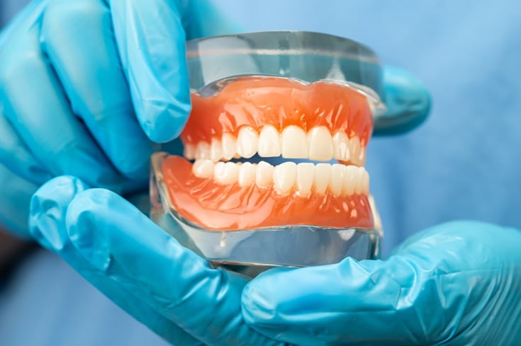 Featured image for “Why Dentures Are a Great Solution for Missing Teeth?”