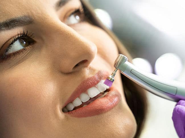 Teeth Whitening Process