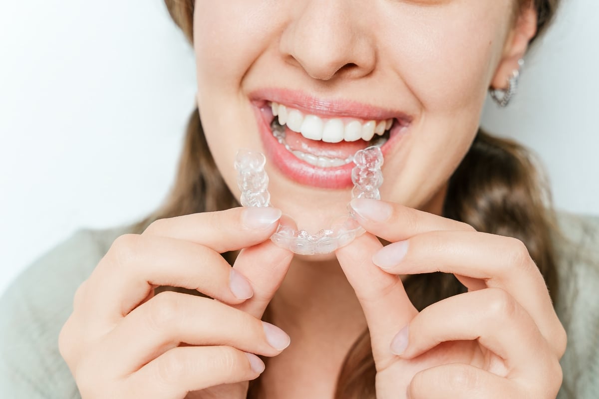 Featured image for “Clear Aligners for Teens: How the System Works for Younger Smiles in Houston”