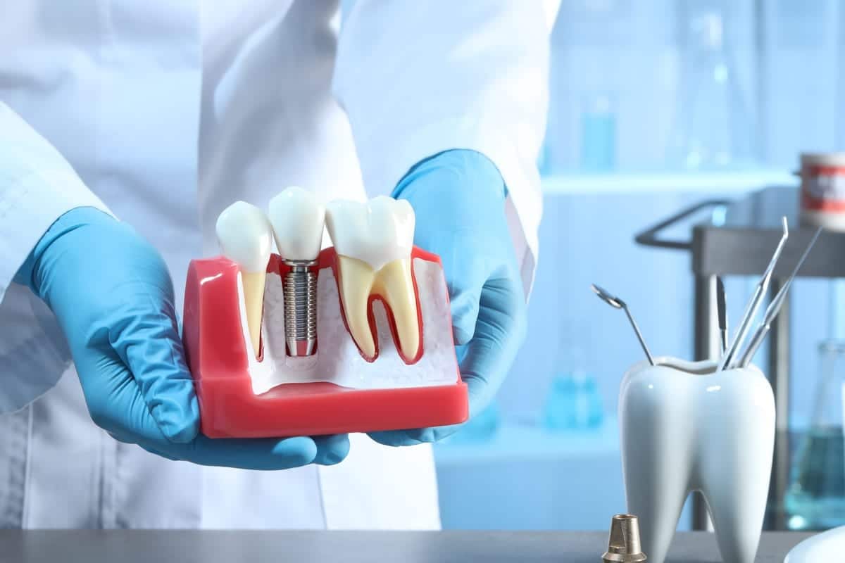 Dental Implants in Houston